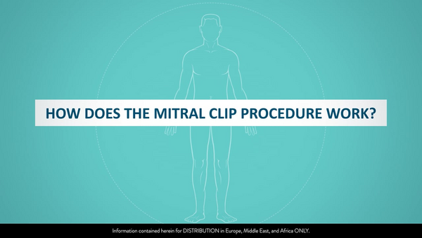 4 9-EH-5-5260-01 08-2025 REV A Mitral Clip procedure-How mitral clip works?