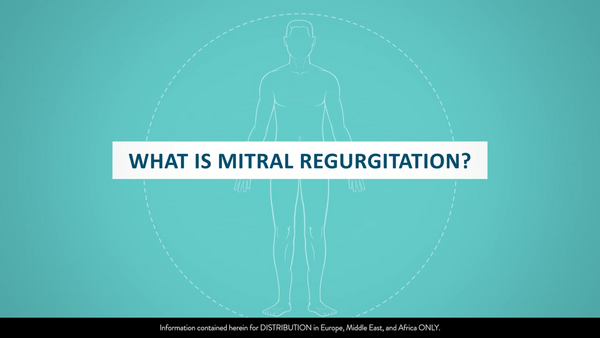 2 9-EH-5-5260-01 08-2025 REV A What is MR